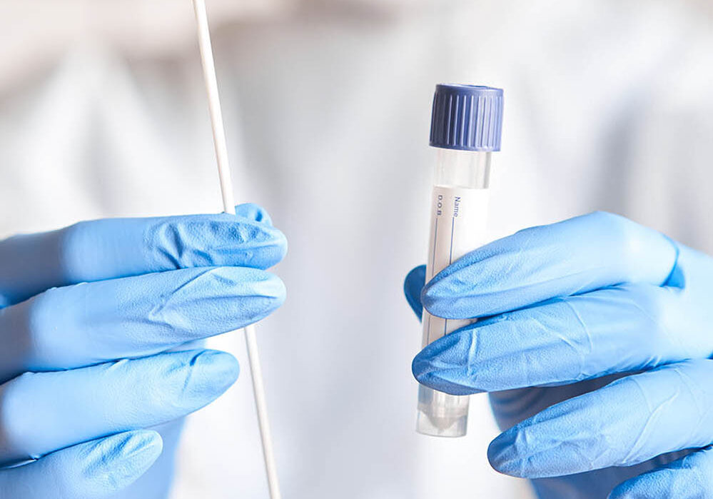 Doctor holding swab test tube for 2019-nCoV analyzing. Coronavirus test. Blue medical gloves and protective face mask for protection against covid-19 virus. Coronavirus and pandemic.